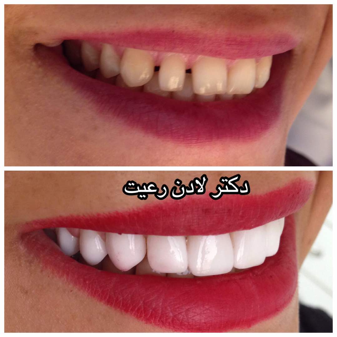 تصویر-دکتر لادن رعیت | جراح و دندانپزشک