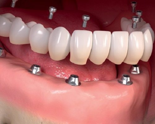 مطب دندانپزشکی دکتر آرش فروحی
