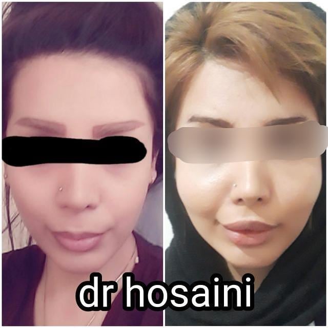 مطب دکتر حسینی