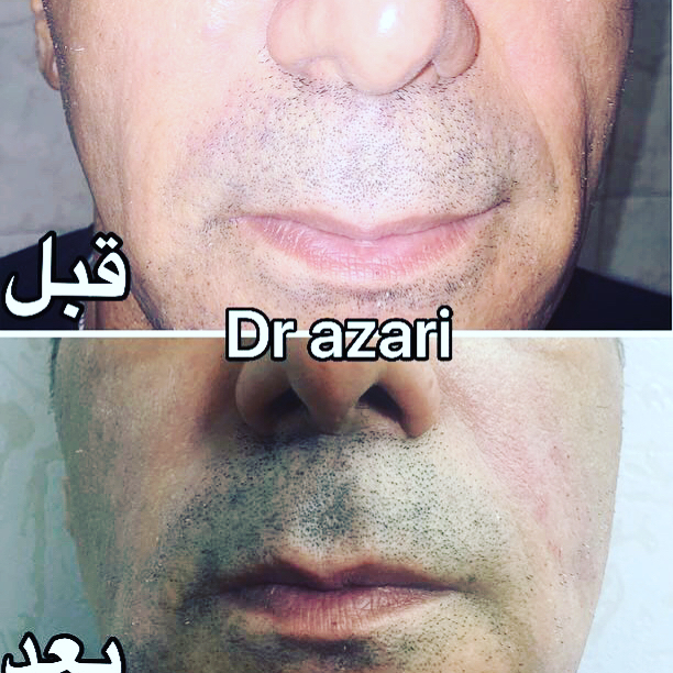 مطب زیبایی دکتر محمدرضا آذری